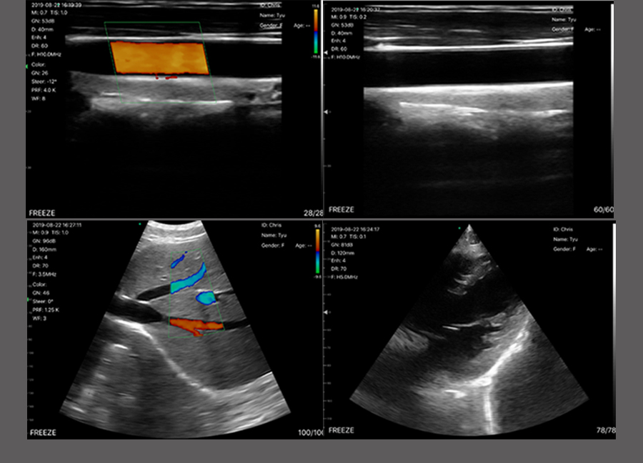 Stacks Image 24